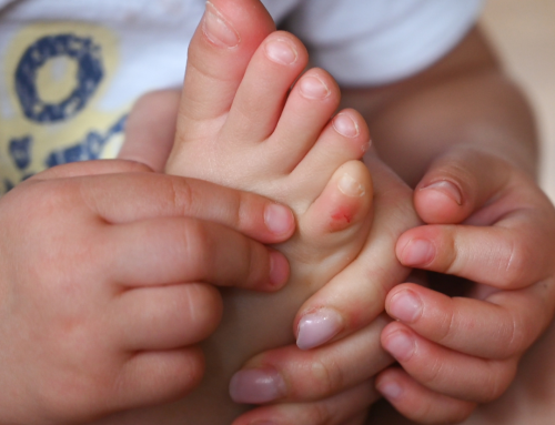 8 Tips For Preventing & Treating Blisters From A Podiatrist